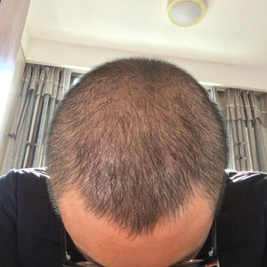 发际线分享社区