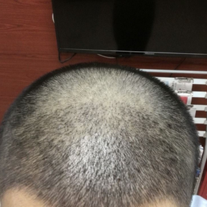 发际线分享社区