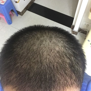 发际线分享社区