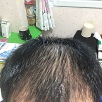 發(fā)際線用戶圖片