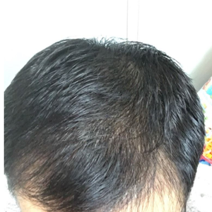 发际线分享社区