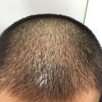 發(fā)際線用戶圖片