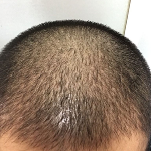 发际线分享社区