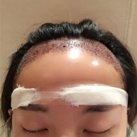 發(fā)際線用戶圖片