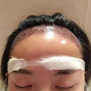 发际线分享社区