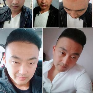 发际线分享社区