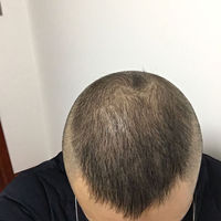 發(fā)際線用戶圖片