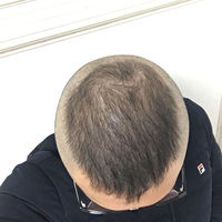 發(fā)際線用戶圖片