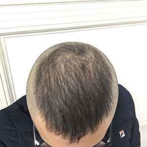 发际线分享社区