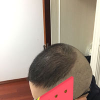 發(fā)際線用戶圖片