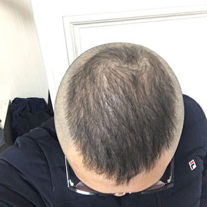 发际线分享社区