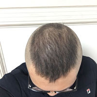 發(fā)際線用戶圖片