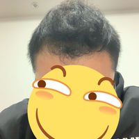 發(fā)際線用戶圖片