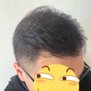 发际线分享社区