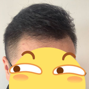 发际线分享社区