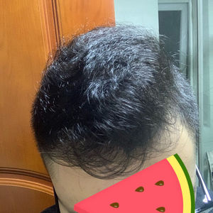 发际线分享社区