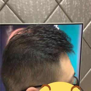 发际线分享社区