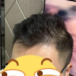 发际线分享社区