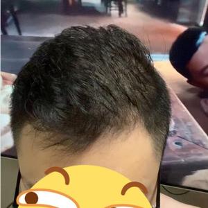 发际线分享社区