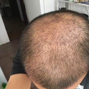 发际线分享社区