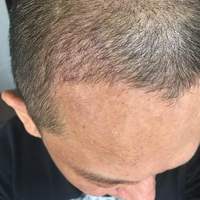 發(fā)際線用戶圖片