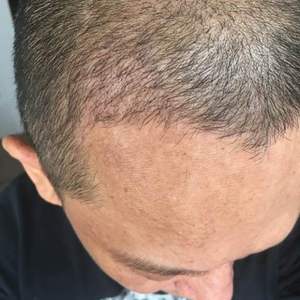 发际线分享社区