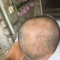 發(fā)際線用戶圖片