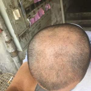 发际线分享社区