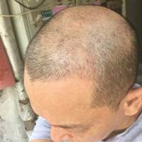 發(fā)際線用戶圖片