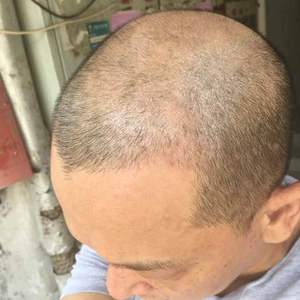 发际线分享社区