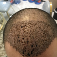 發(fā)際線用戶圖片