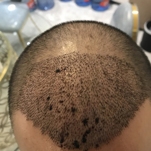 发际线分享社区