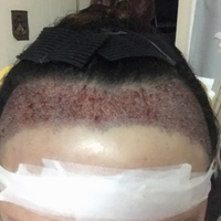 發(fā)際線用戶圖片