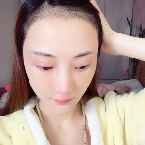 发际线分享社区