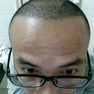 发际线分享社区