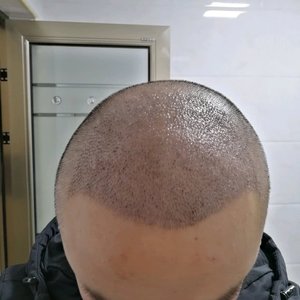 发际线分享社区