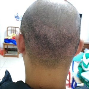 发际线分享社区