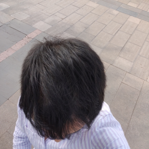 发际线分享社区