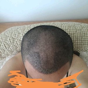 发际线分享社区