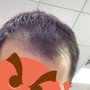 发际线分享社区
