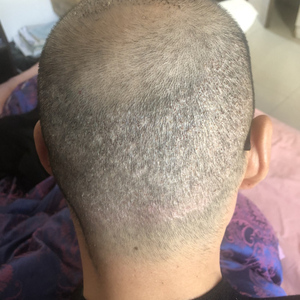 发际线分享社区