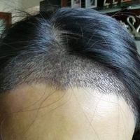 發(fā)際線用戶圖片