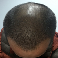 發(fā)際線用戶圖片