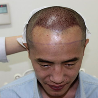發(fā)際線用戶圖片