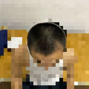 发际线分享社区