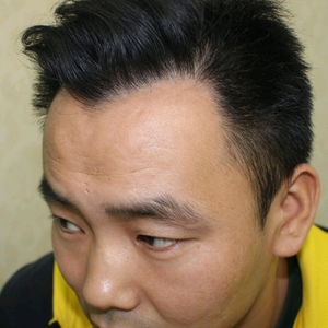 发际线分享社区
