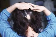 女性掉发会像男性一样脱发成秃顶吗?