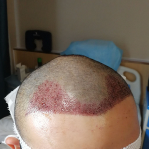 发际线分享社区
