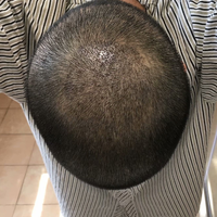 禿頂用戶圖片