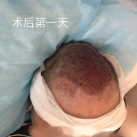 禿頂用戶圖片